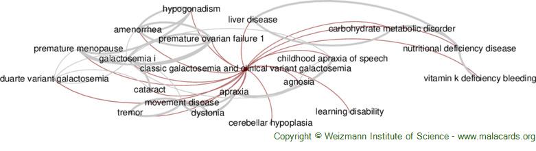 Classic Galactosemia And Clinical Variant Galactosemia Disease