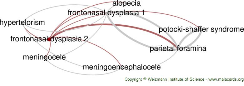 Frontonasal Dysplasia 2 Disease Malacards Research Articles Drugs