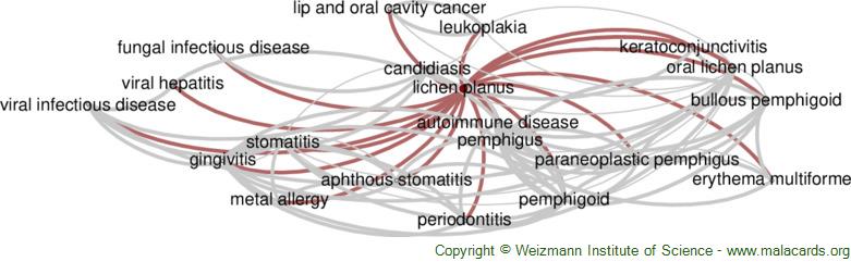 Lichen Planus disease: Malacards - Research Articles, Drugs, Genes 