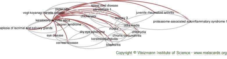 Keratoconjunctivitis Sicca disease: Malacards - Research Articles 