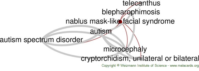 Nablus Mask Like Facial Syndrome Disease Malacards Research Articles Drugs Genes Clinical