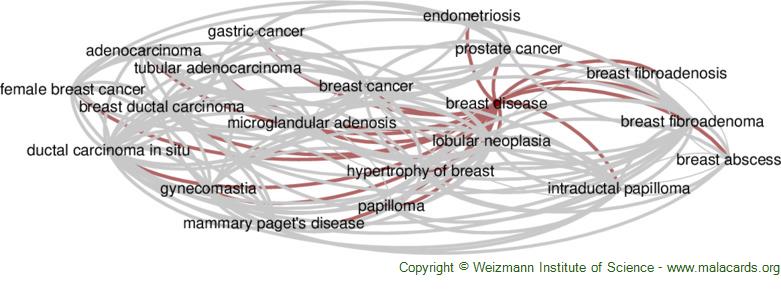 Cellular and hormonal content of breast nipple aspirate fluid in relation  to the risk of breast cancer