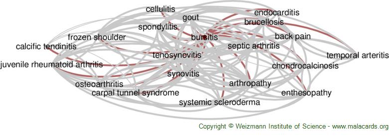 Bursitis disease: Malacards - Research Articles, Drugs, Genes