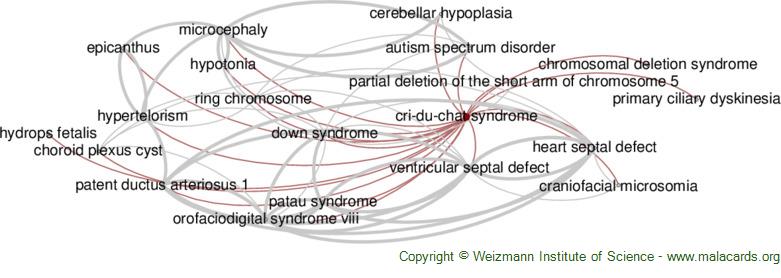 Cornelia de Lange Syndrome - GeneReviews® - NCBI Bookshelf