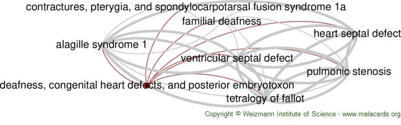 posterior embryotoxon alagille syndrome
