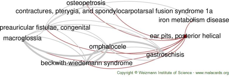 Beckwith-Wiedemann Syndrome - GeneReviews® - NCBI Bookshelf