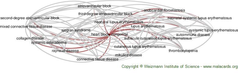 Atrioventricular block - Wikipedia