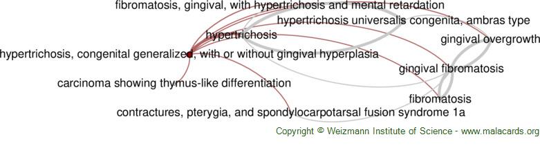 congenital hypertrichosis universalis