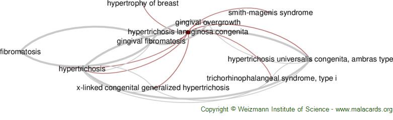 congenital hypertrichosis universalis