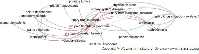 Loin pain haematuria syndrome –