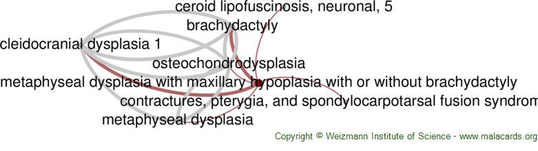 maxillary hypoplasia