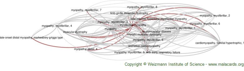 FLNC-Associated Myofibrillar Myopathy