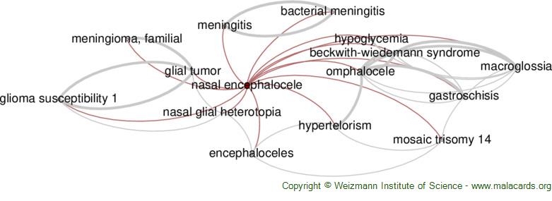 Beckwith-Wiedemann Syndrome - GeneReviews® - NCBI Bookshelf