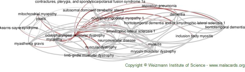 Pharyngeal aspiration - Wikipedia