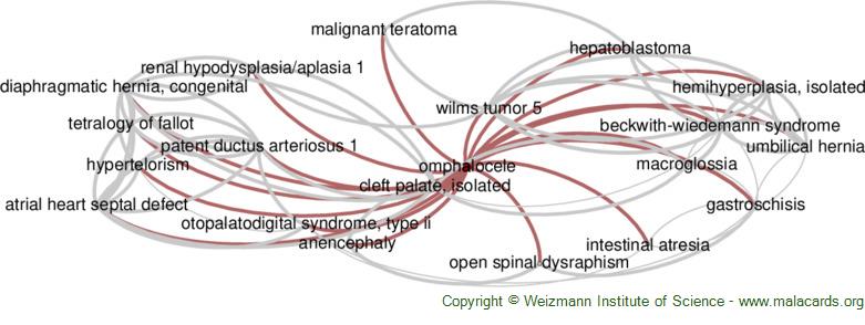 Omphalocele as component of multiple anomaly syndrome/sequence