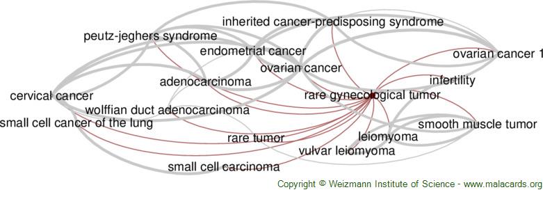 Rare Gynecological Tumor Disease: Malacards - Research Articles, Drugs ...