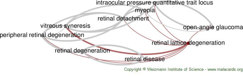 Retinal Detachment - Robson Eye Institute