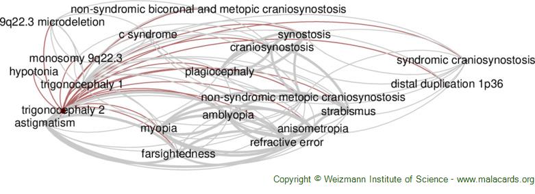 trigonocephaly
