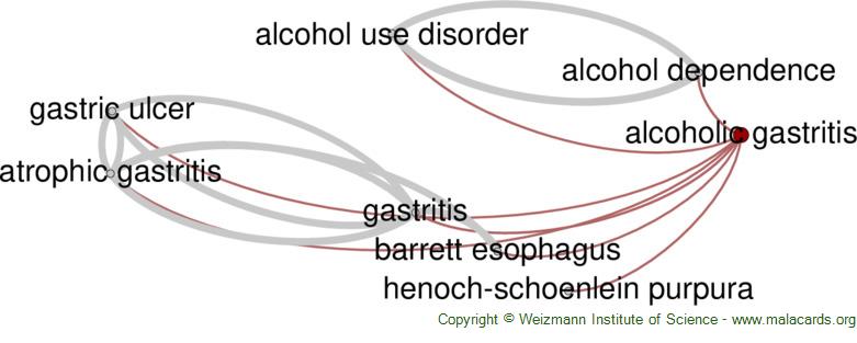 Diseases related to Alcoholic Gastritis