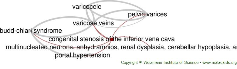 Diseases related to Congenital Stenosis of the Inferior Vena Cava