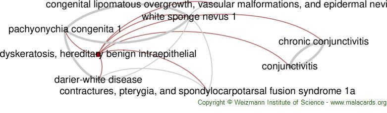 hereditary benign intraepithelial dyskeratosis