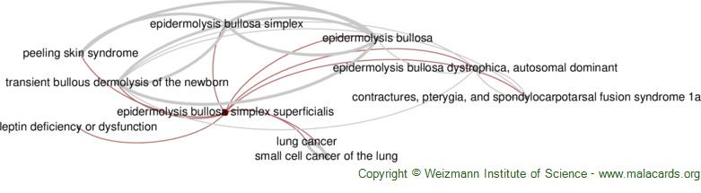 Diseases related to Epidermolysis Bullosa Simplex Superficialis
