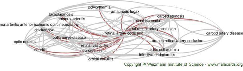 Diseases related to Retinal Artery Occlusion