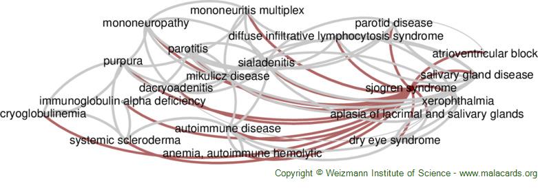 Diseases related to Sjogren Syndrome