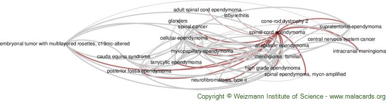 Diseases related to Spinal Cord Ependymoma