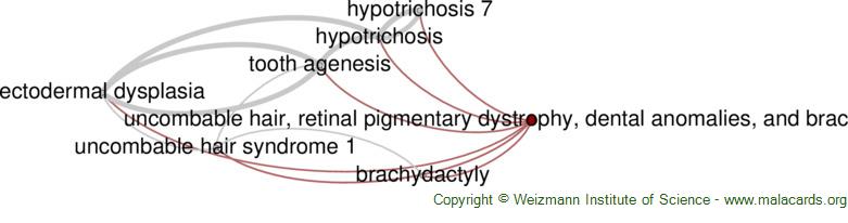 Diseases related to Uncombable Hair, Retinal Pigmentary Dystrophy, Dental Anomalies, and Brachydactyly