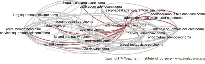 Diseases related to Adenosquamous Carcinoma