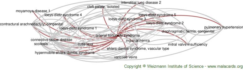 Diseases related to Arterial Tortuosity Syndrome