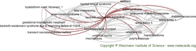 Diseases related to Beckwith-Wiedemann Syndrome