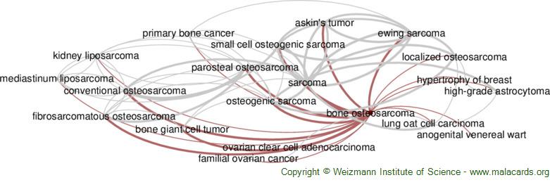 Diseases related to Bone Osteosarcoma