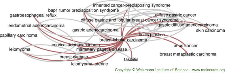 Diseases related to Breast Lobular Carcinoma