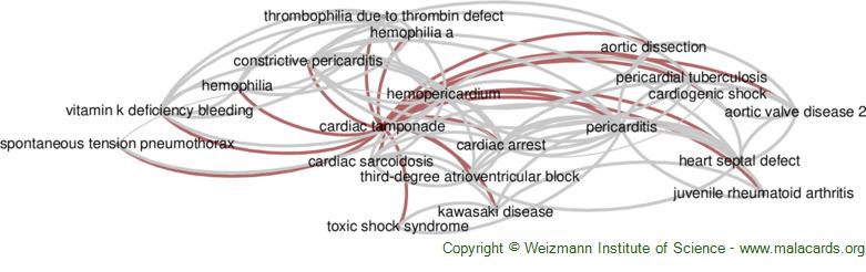 Diseases related to Cardiac Tamponade