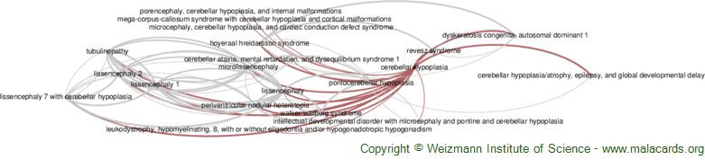Diseases related to Cerebellar Hypoplasia