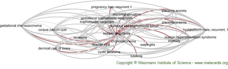 Diseases related to Ectopic Pregnancy