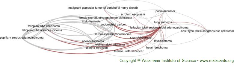 Diseases related to Fallopian Tube Endometrioid Adenocarcinoma