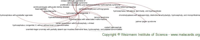 Diseases related to Hydrocephalus, Congenital, 1