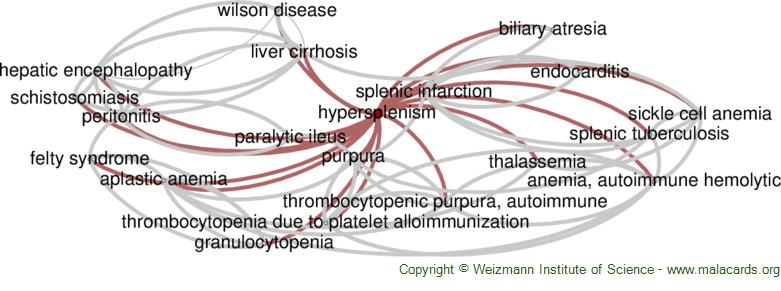 Diseases related to Hypersplenism