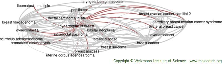 Diseases related to Hypertrophy of Breast