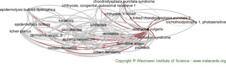 Diseases related to Ichthyosis Vulgaris