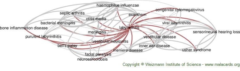 Diseases related to Labyrinthitis