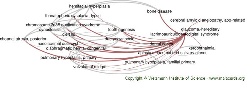 Diseases related to Lacrimoauriculodentodigital Syndrome