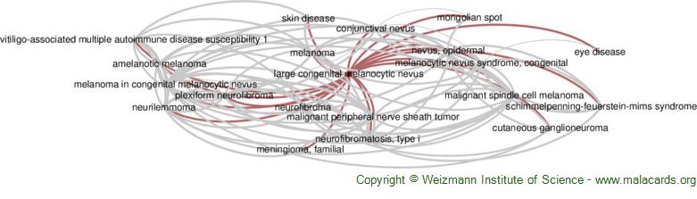 Diseases related to Large Congenital Melanocytic Nevus