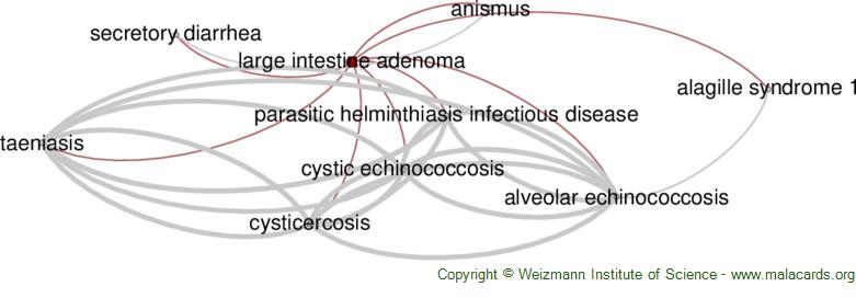 Diseases related to Large Intestine Adenoma