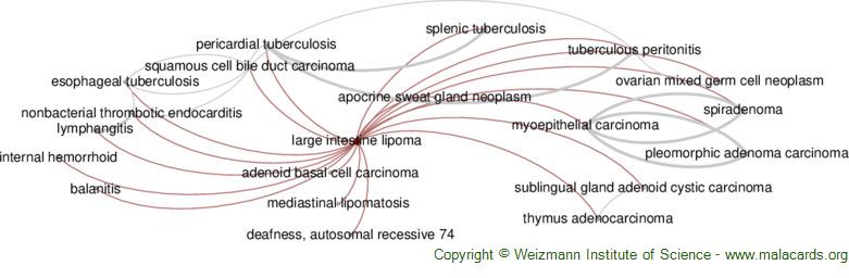 Diseases related to Large Intestine Lipoma