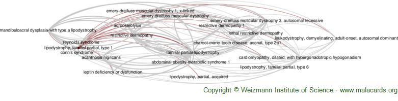 Diseases related to Lipodystrophy, Familial Partial, Type 1