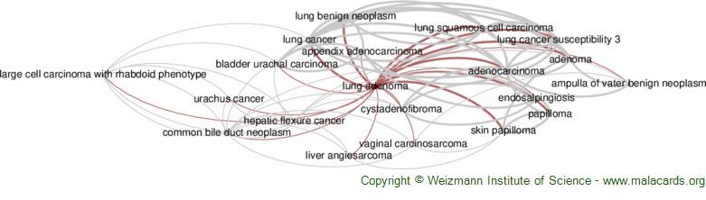 Diseases related to Lung Adenoma